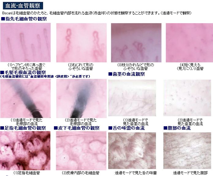 血流サンプル
